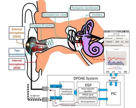 Otoacoustic Emissions .